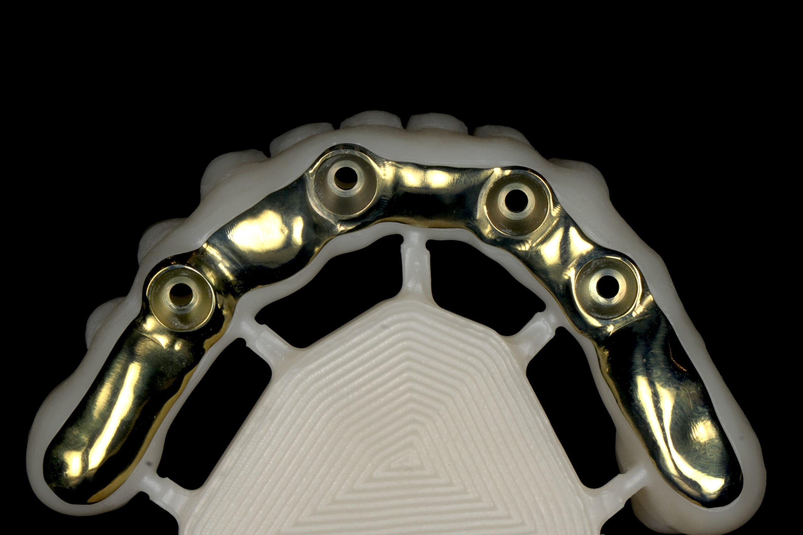 Flux numerique CAD CAM au laboratoire ISDL