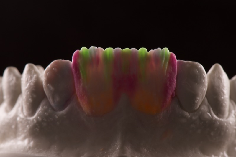 Ceramique stratifiee au laboratoire ISDL